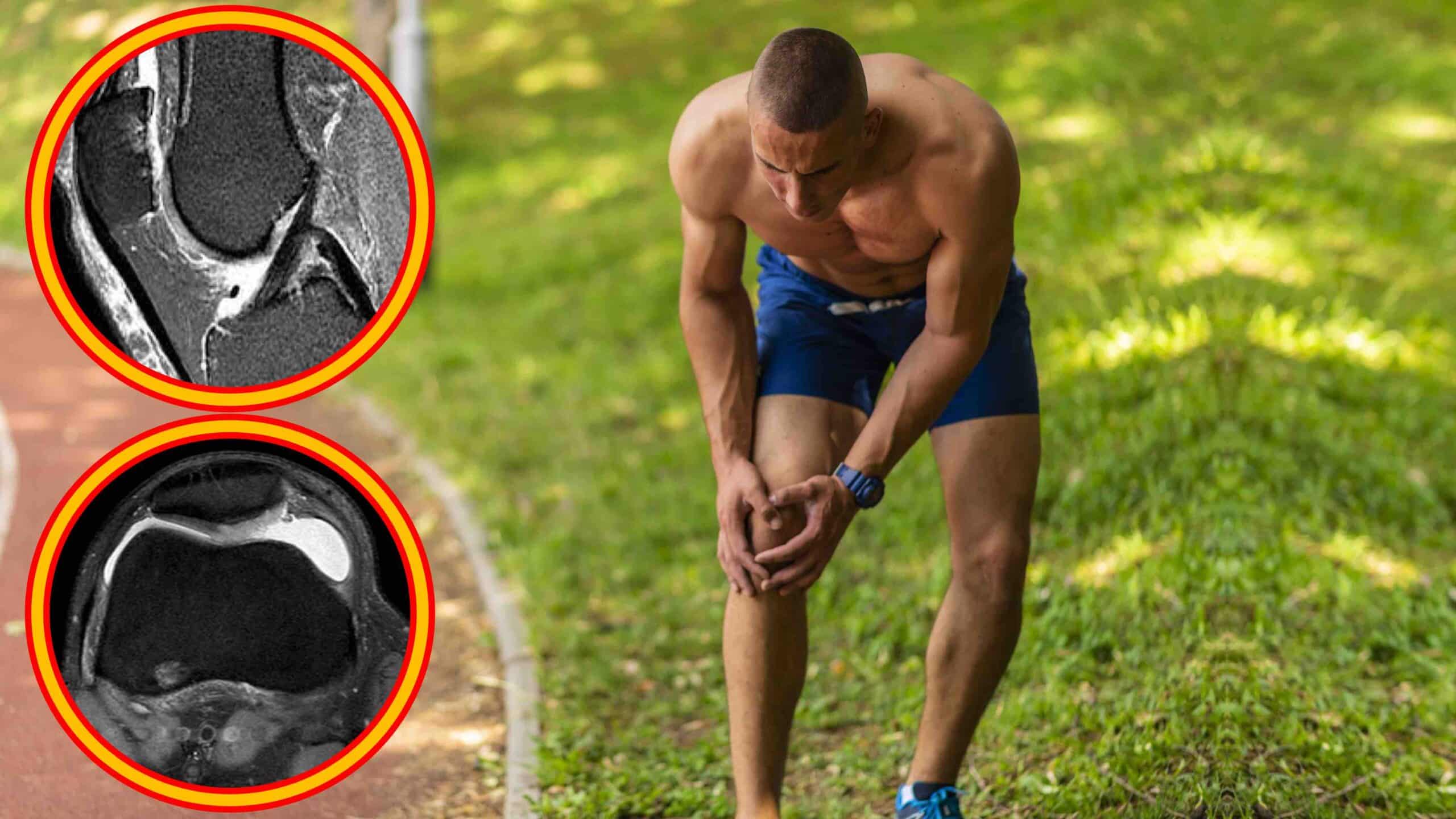 Seu joelho não é o problema… seu treino é